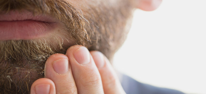 Deal with Dry Skin under Beard